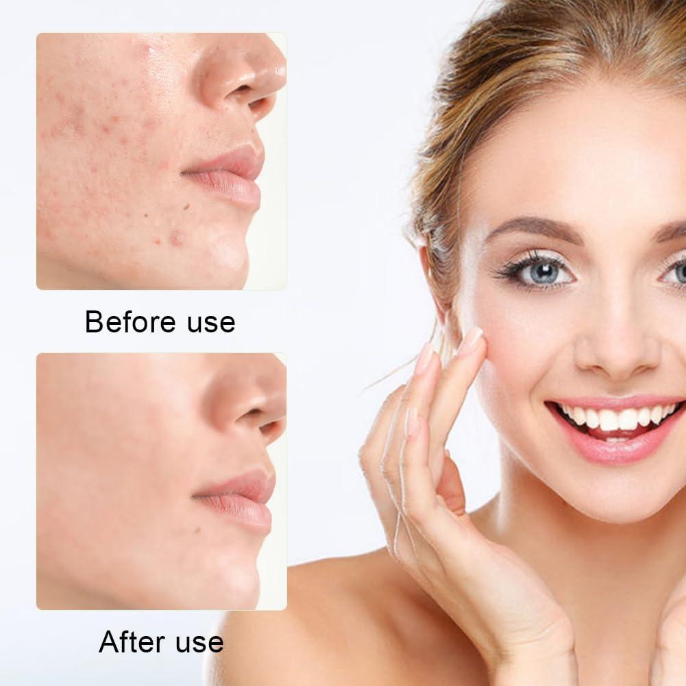 Urapra Glycolic Acid 7% Toning Solution